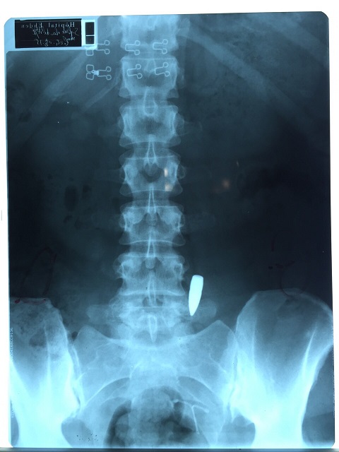 1438702341_IMG20150804WA0017