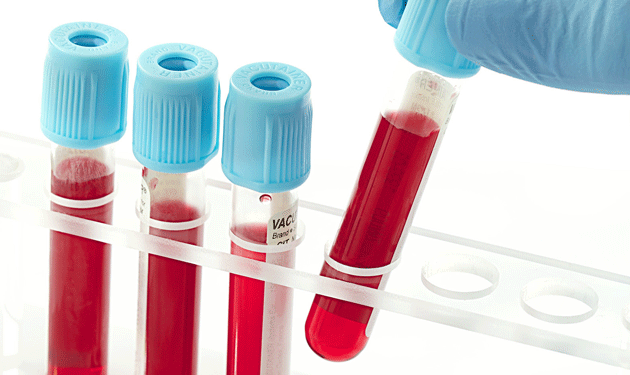 blood-test