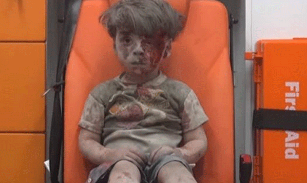 amran-syria-aleppo-child