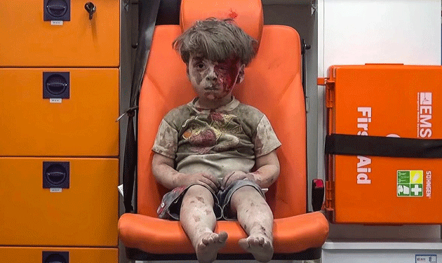 syrian-baby-Omran-Daqneesh