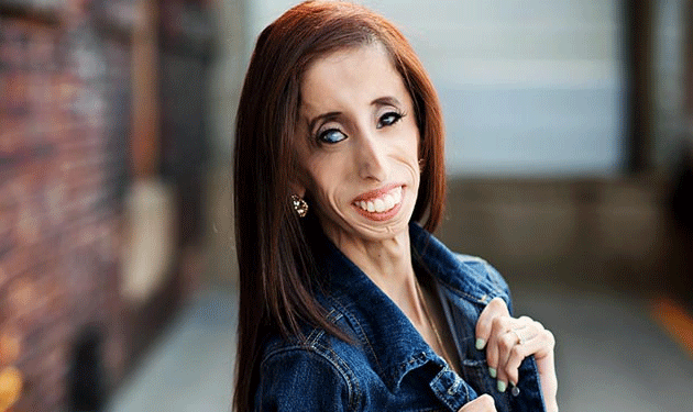 lizzie-velasquez