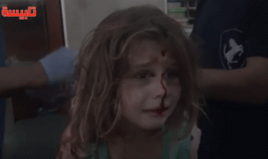 بالفيديو… طفلة سورية جريحة تنادي والدها
