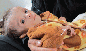 اليمن… طفل يموت كل 10 دقائق
