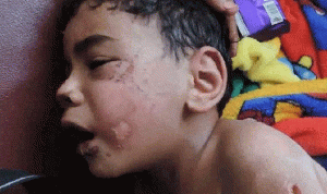 ابن الـ5 سنوات ضحية لأبشع أنواع التعذيب… والأم الفاعلة! (بالصور)