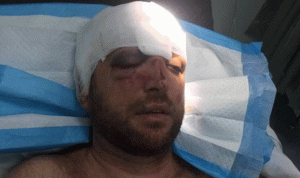 بالصور… عضو بلدية عين دارة يتعرّض للضرب!