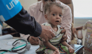 وباء الكوليرا في اليمن يواصل انتشاره