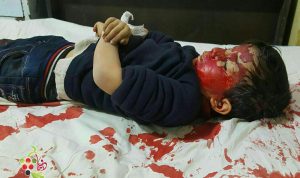 بالصور… الأسد يقصف دوما بالكلور