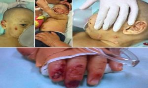 لبناني في الباراغواي… عذّب طفل الـ16 شهراً بوحشية لا تصدق