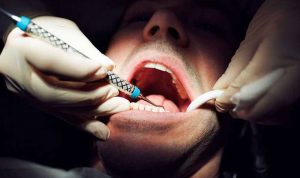 قطاع أطباء الاسنان دان الاعتداء على أحد الزملاء