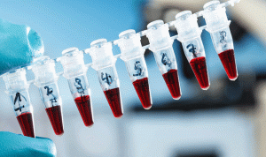 خلية الأزمة في عدلون تكشف عن نتائج  الـ PCR لـ 31 شخصا