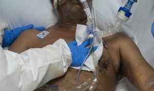 عملية فتح حنجرة لمصاب بكورونا في مستشفى نبيه بري