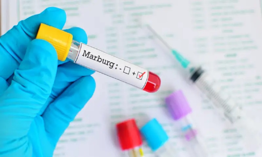 “الصحة العالمية”: فيروس ماربورغ قادر على قتل المصاب بـ3 أيام!