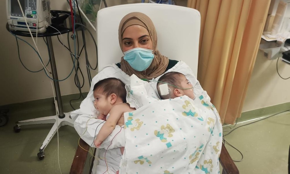إنجاز طبي لبناني: عمليّة فصل نادرة لطفلَين!