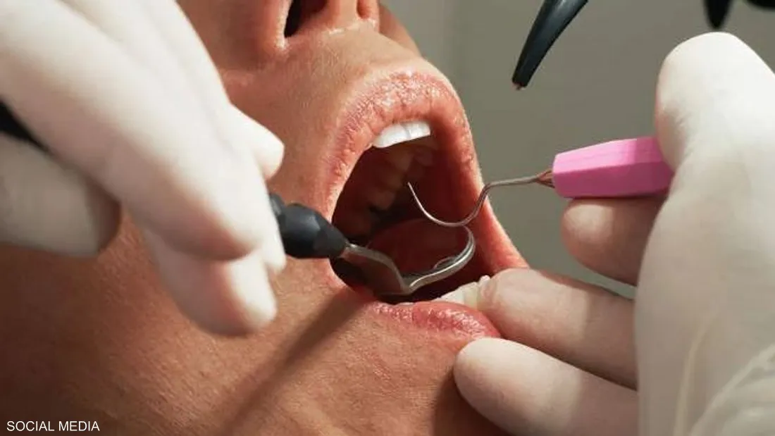 عامل نظافة ينتحل صفة طبيب أسنان والمريض يدفع الثمن