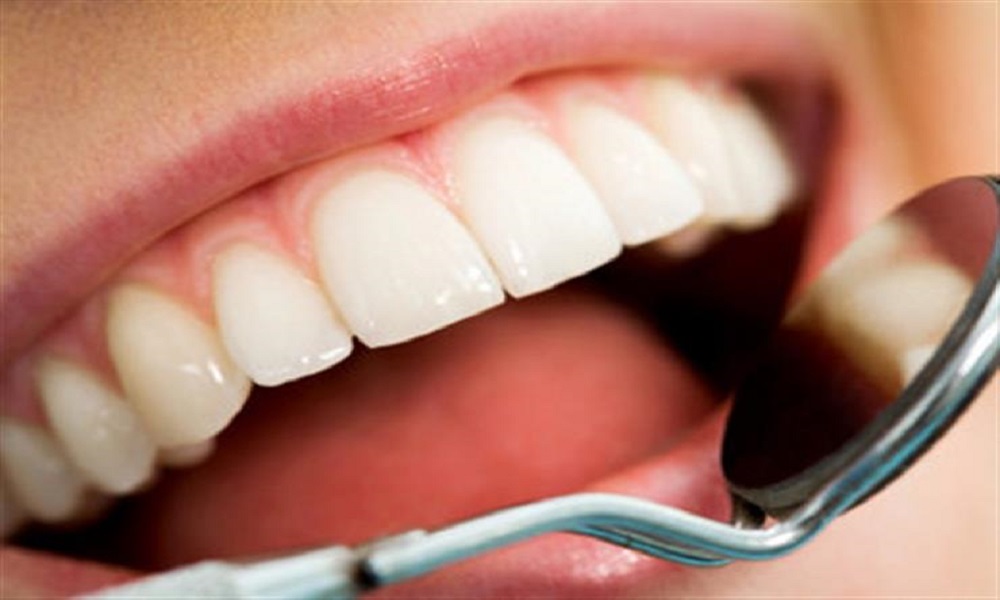 إليكم تأثير المواد الغذائية على صحّة الأسنان