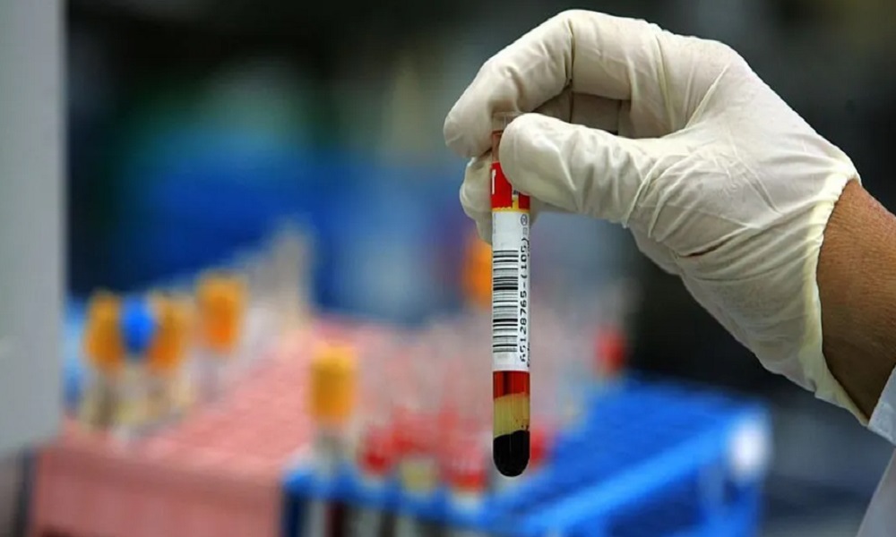 6 اختبارات دم ضرورية تكشف أسرار صحتك