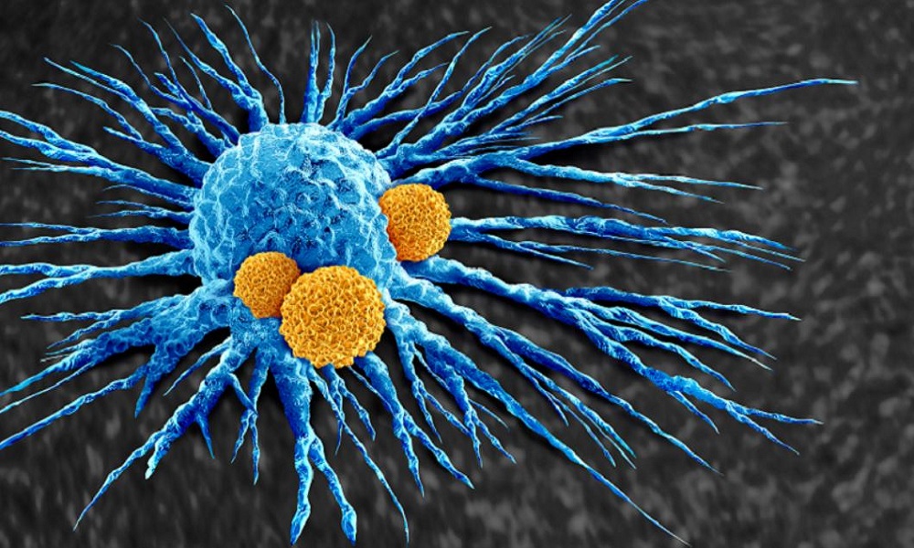 تطوير لقاح تجريبي يعزز فعالية العلاج المناعي للسرطان