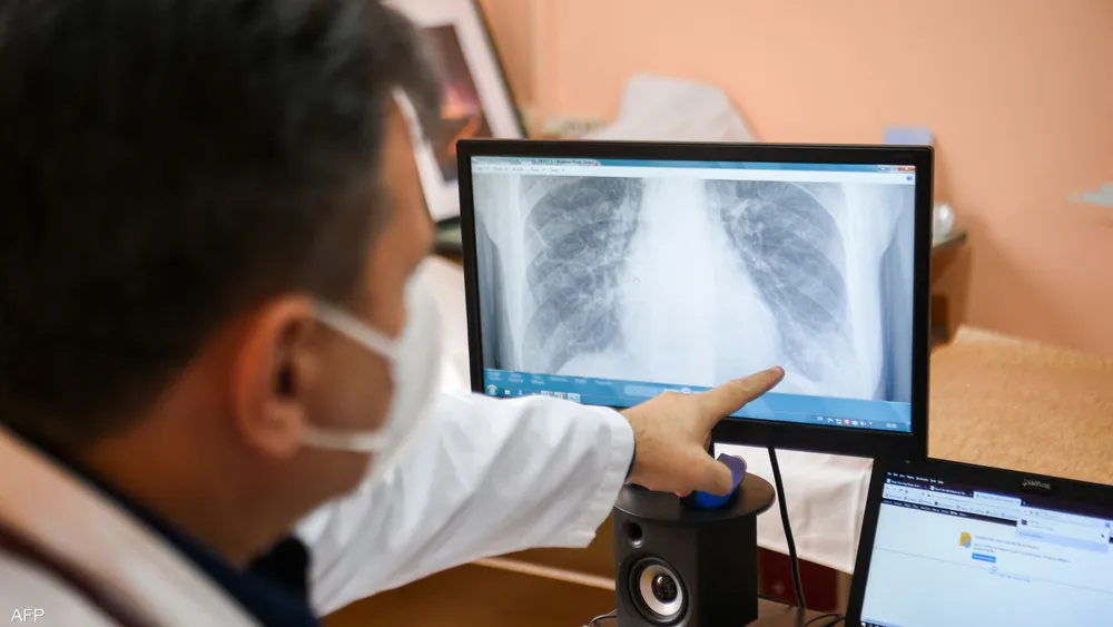 هذه الفواكه تحمي الرئتين من أضرار تلوث الهواء