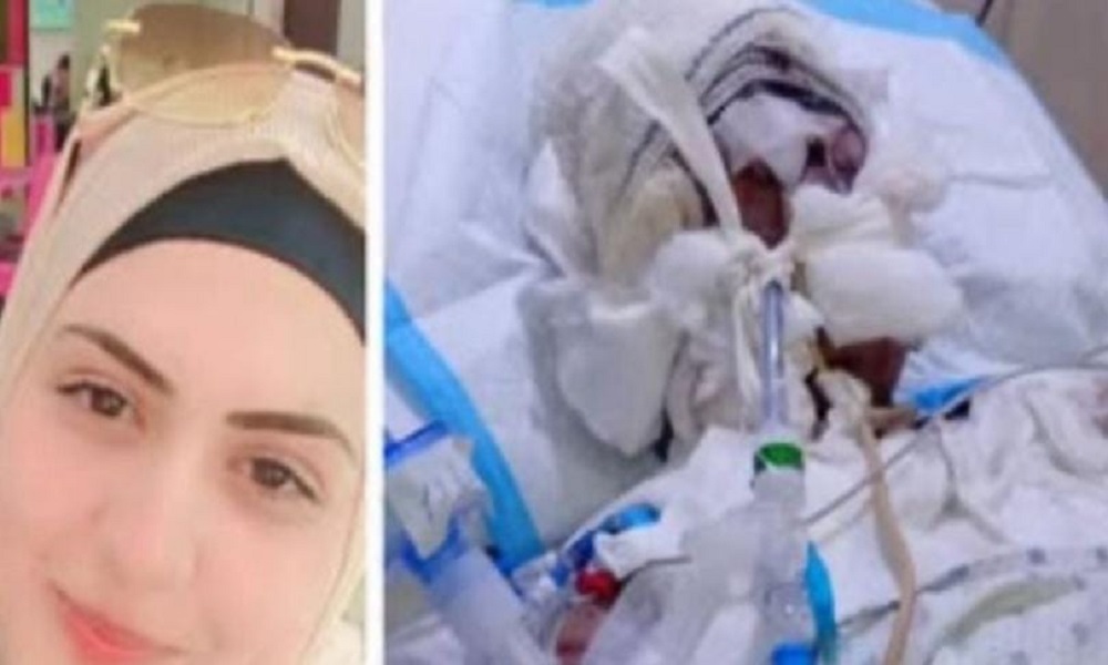 أحرق زوجته بالزيت ورماها… و”الأمن” بالمرصاد!