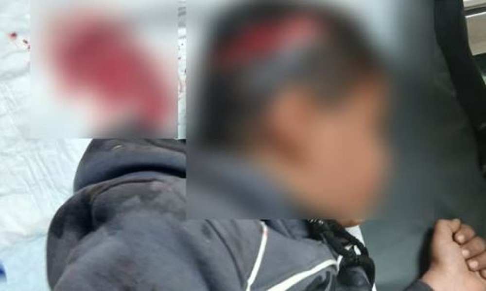 كلب يمزّق فروة رأس طفل في بعلبك