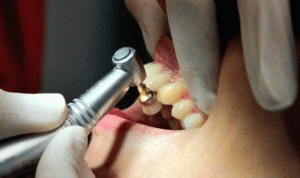 مستوردو مواد طب الأسنان: نحذر من اقفال عام الجمعة