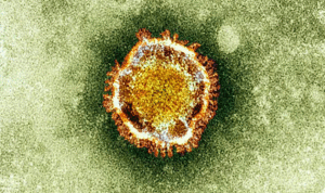 ما هو فيروس “كورونا” ؟